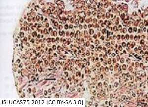 zooxanthellae article image 1